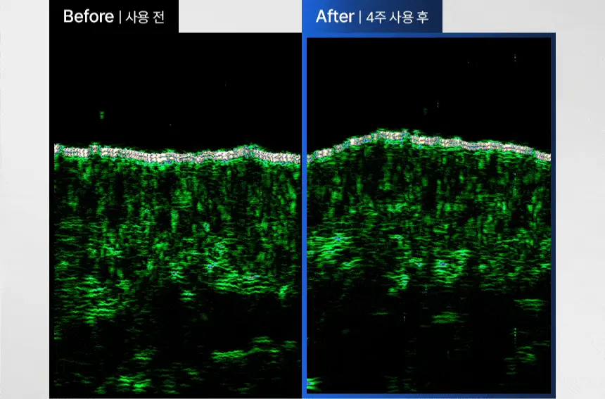 [한정기획] 바이브랩 스피옥실 리액트샷 800 50ml 기획(+인핸싱폼 33ml 증정) 상세페이지 19